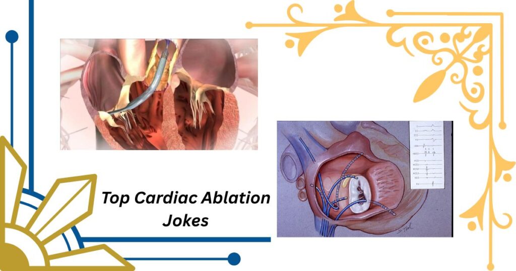 Quick Ablation Jokes to Share During Medical Procedures