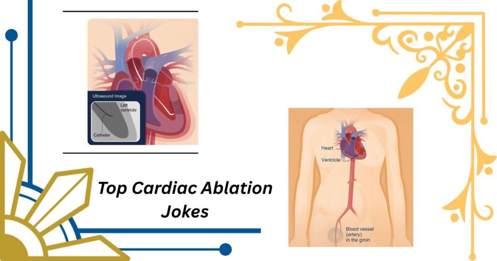 Top Cardiac Ablation Jokes Every Heart Patient Should Know